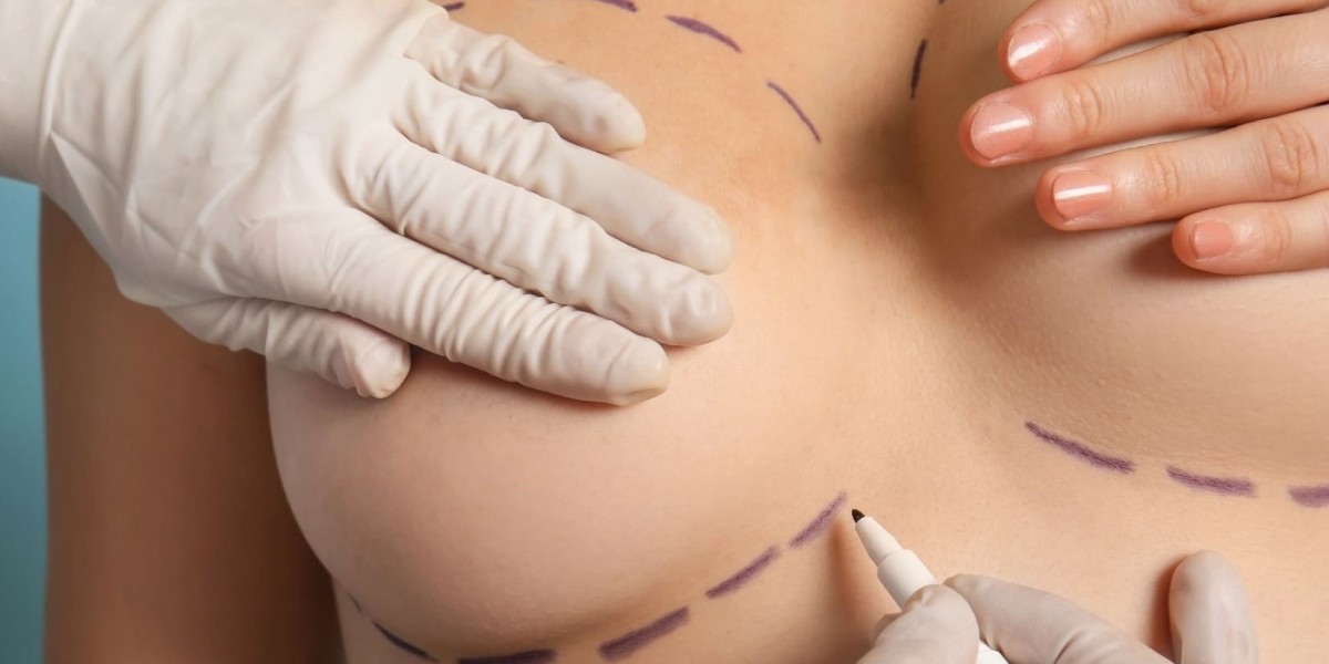 What to Expect After Breast Fat Transfer in Dubai