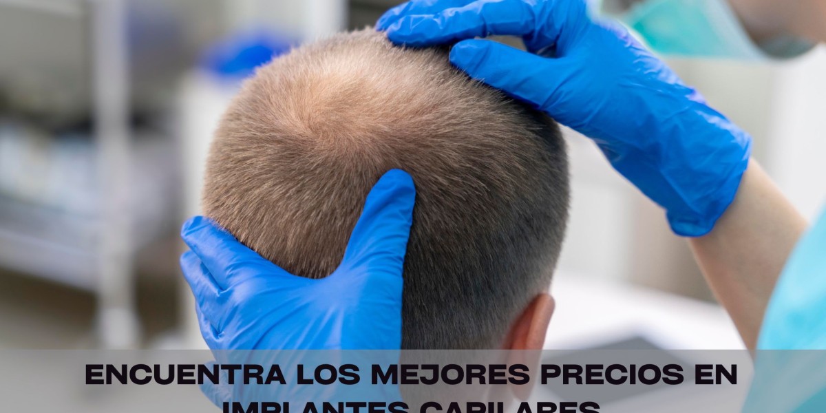 Encuentra los mejores precios en implantes capilares