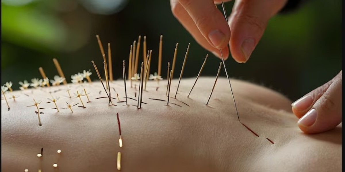 Discovering the Benefits of Visiting an Acupuncture Clinic