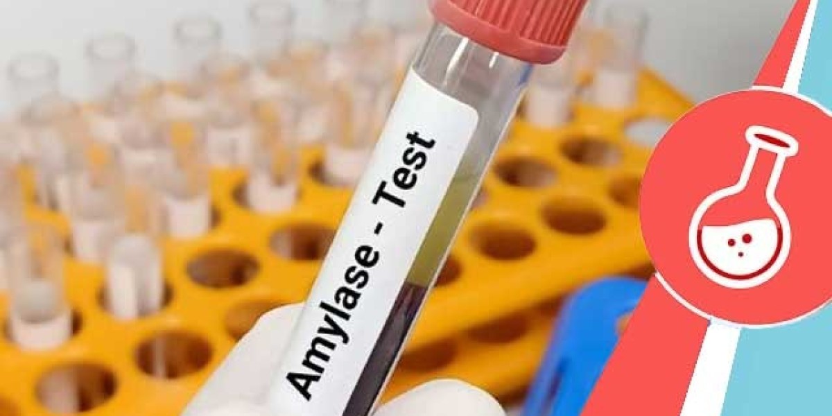 Amylase Testing Market 2023 Major Key Players and Industry Analysis Till 2032