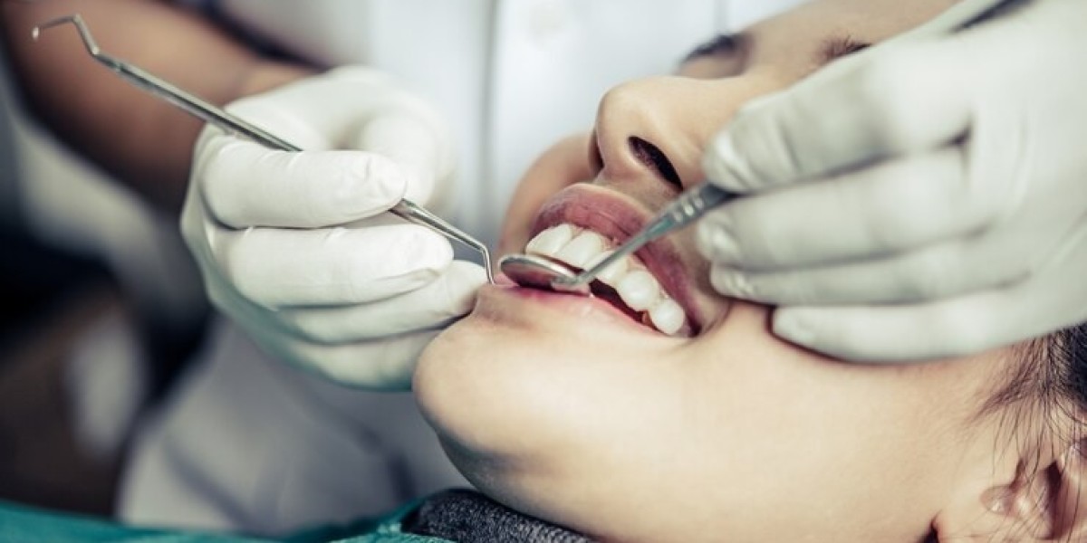 Top Benefits of Getting a Dental Filling in Islamabad