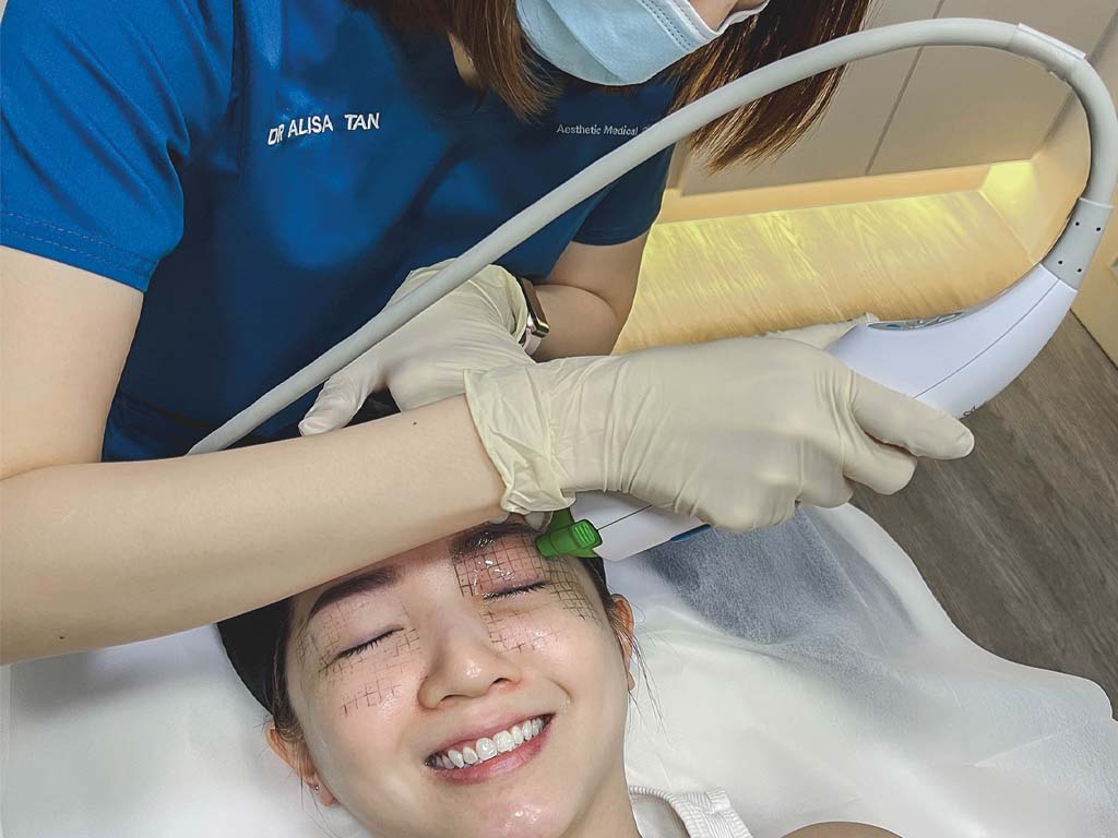 Non-Surgical Upper Eyelid Lift Singapore | Dr D Aesthetic Clinic