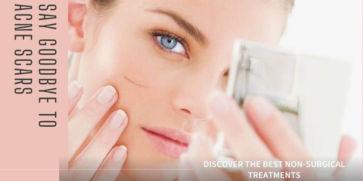 Surgical Scars to Fading Memories: Top Scar Removal Players in Action