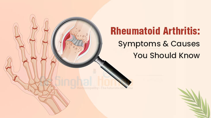 Understanding Common Symptoms of Rheumatoid Arthritis