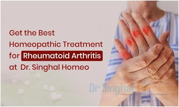 Getting Personalized & Effective Homeopathic Medicines for Rheumatoid Arthritis Treatment