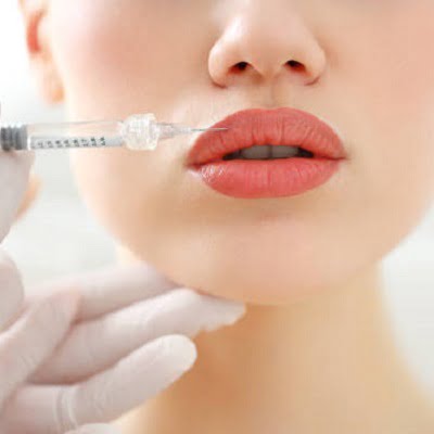 Lip Fillers in Islamabad Pakistan - Lip Augmentation