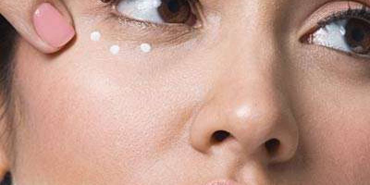 How to Choose the Right Dark Circles Treatment