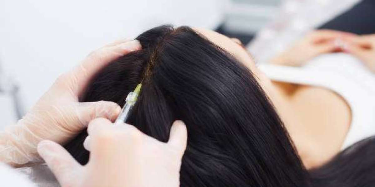 Revitalize Your Mane with Advanced PRP in Riyadh Salons